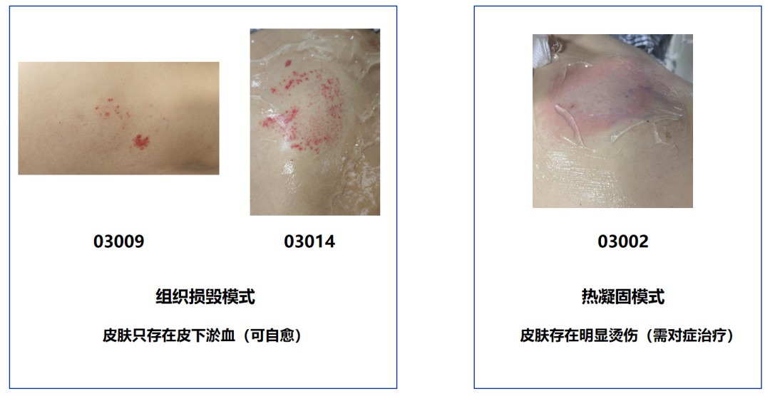 /uploads/image/2025/11/14/239338d1bba2dc019bb6a537f6795fdf.jpg 239338d1bba2dc019bb6a537f6795fdf.jpg