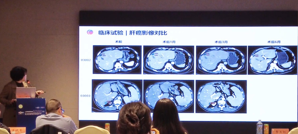 /uploads/image/2025/11/14/c2ac20981a3d7384f256605e83562e14.jpg c2ac20981a3d7384f256605e83562e14.jpg